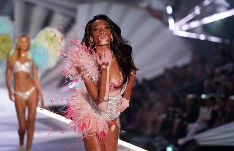  Victoria  s Secret  model  Winnie Harlow has vitiligo and she 